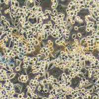 小鼠脑神经瘤细胞；Neuro-2a（种属鉴定）