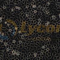 人甲状腺癌乳头状细胞;Bcpap(STR)