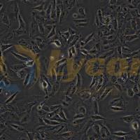 人膀胱移行细胞癌细胞；TCCSUP(STR)