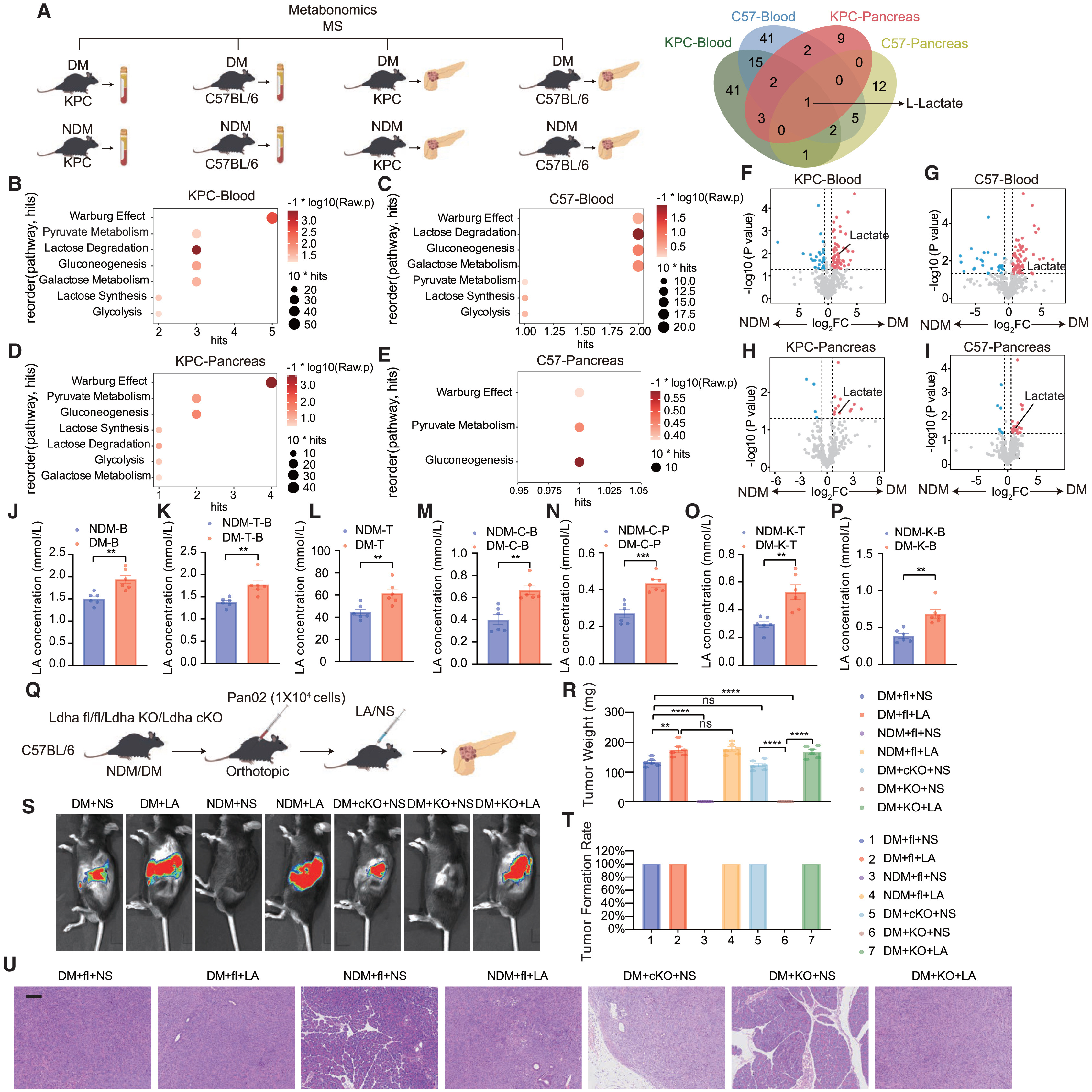 Cell Metabolism | 瑞金医院破解“糖癌”免疫逃逸密码，瑞舒伐他汀或成糖尿病相关胰腺癌患者救星