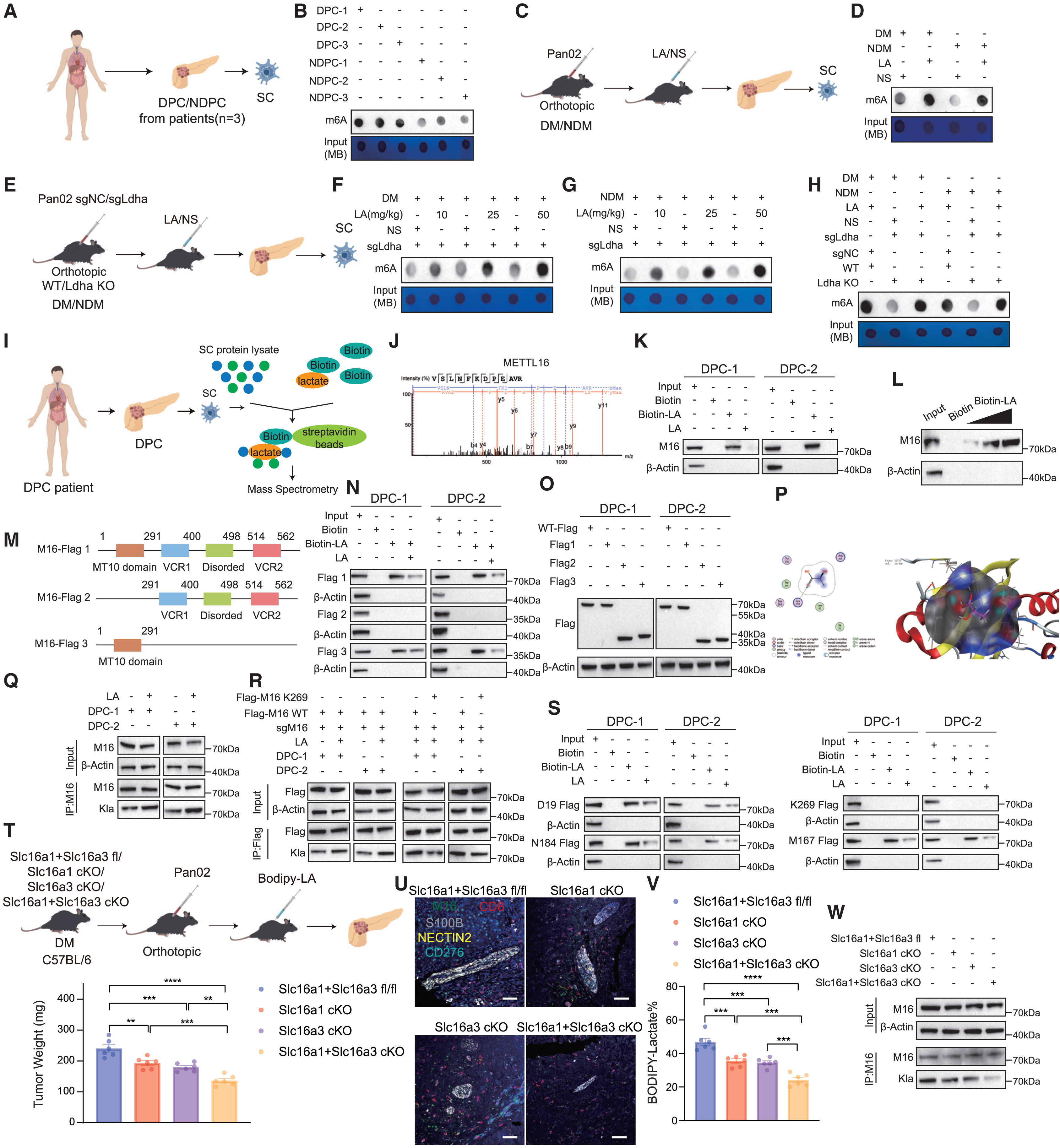 Cell Metabolism | 瑞金医院破解“糖癌”免疫逃逸密码，瑞舒伐他汀或成糖尿病相关胰腺癌患者救星