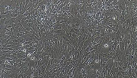 猪原代心肌成纤维细胞性能特点