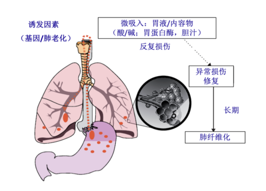 科研干货肺纤维化研究