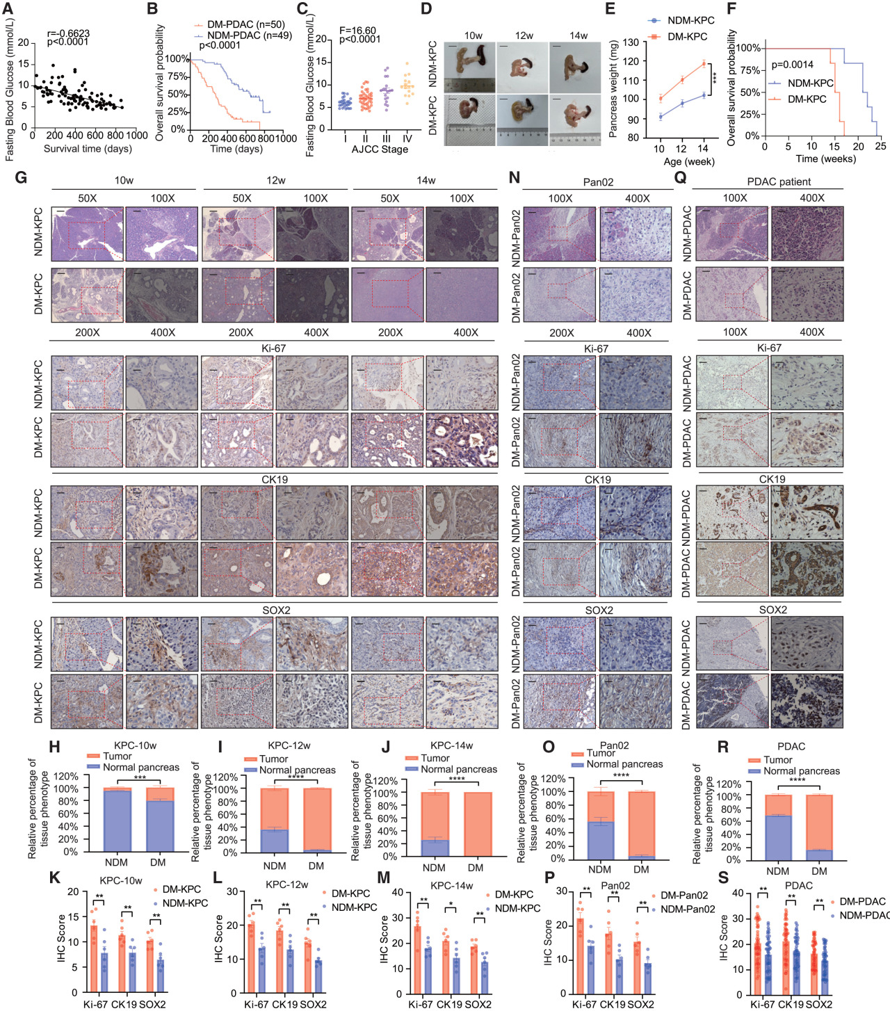 Cell Metabolism | 瑞金医院破解“糖癌”免疫逃逸密码，瑞舒伐他汀或成糖尿病相关胰腺癌患者救星