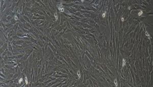 猪原代膀胱平滑肌细胞性能特点