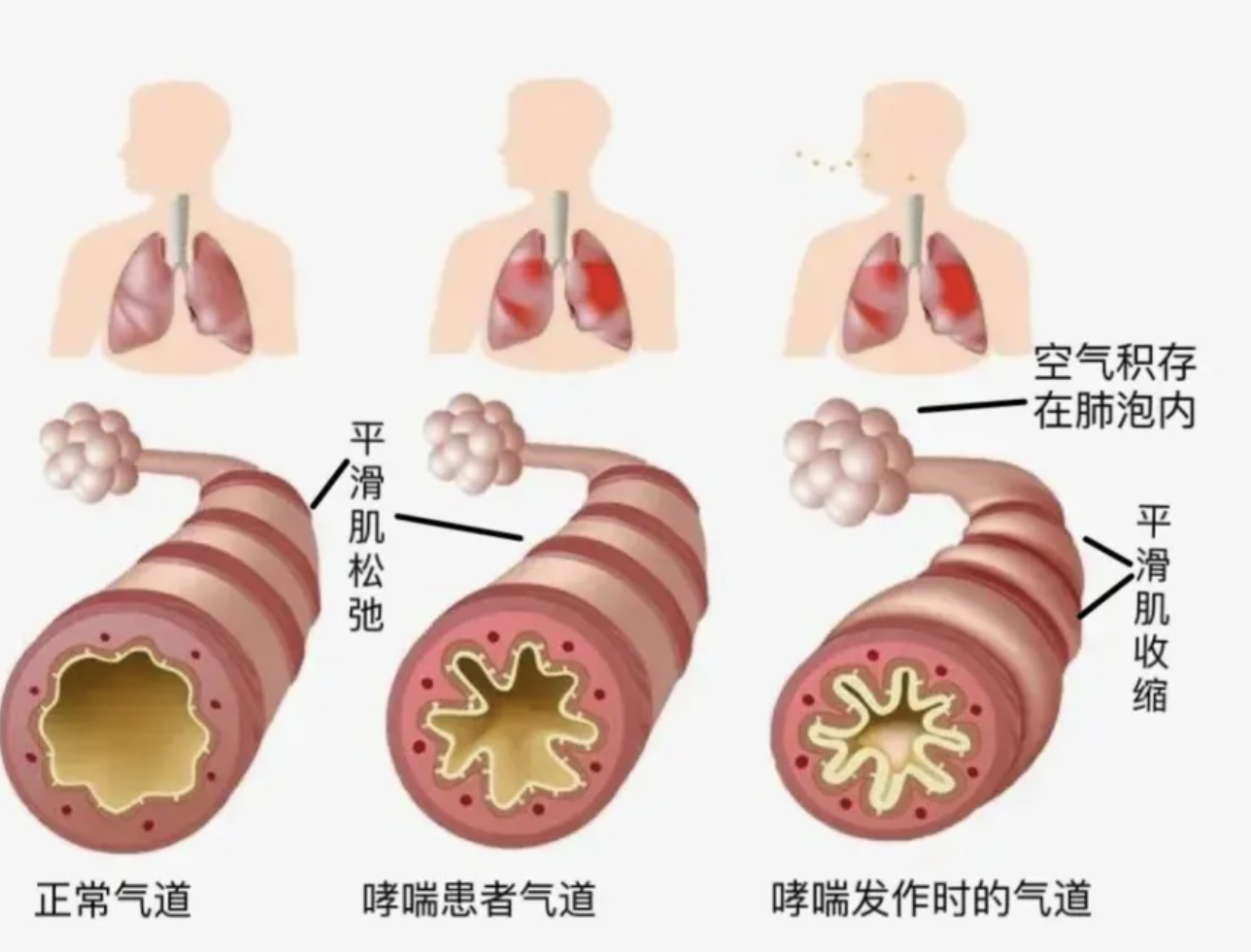 WBP全身体积描记系统