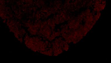 hPSC 诱导多巴胺神经元分化攻略