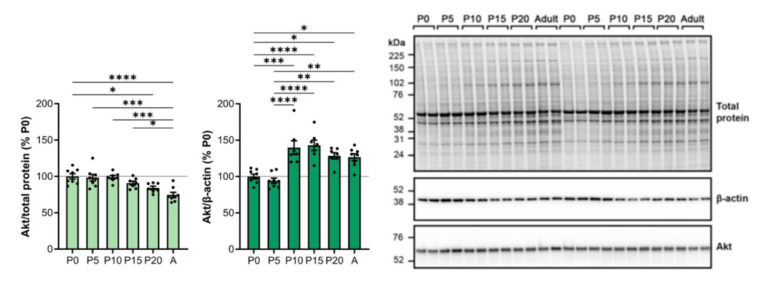 科研避坑指南——被高估的"管家蛋白"：你的实验数据可能已经失真