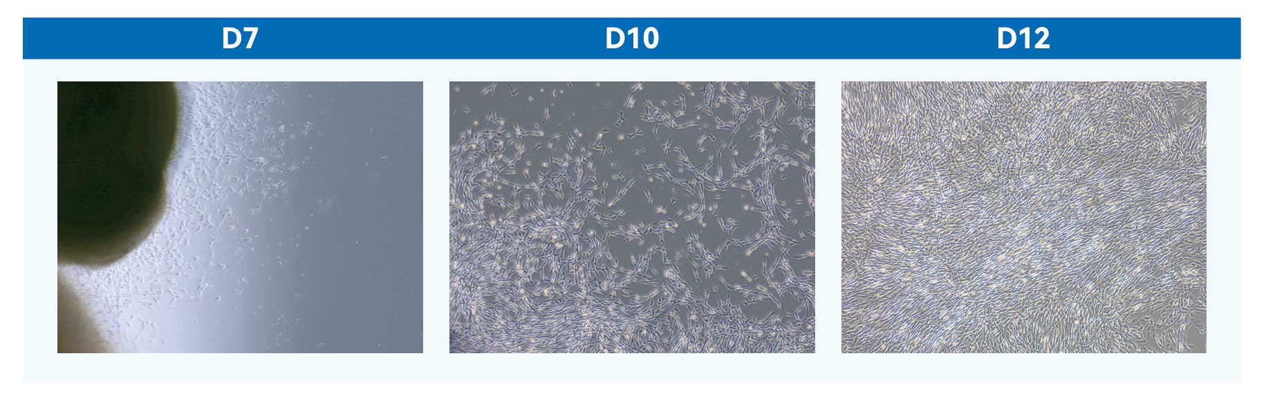 间充质干细胞无血清培养基