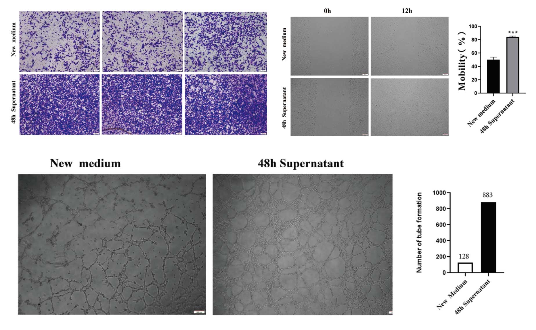 间充质干细胞无血清培养基
