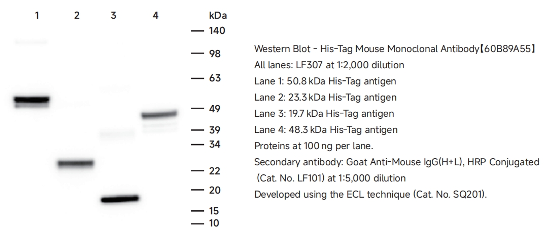 LF307 His-Tag鼠单克隆抗体