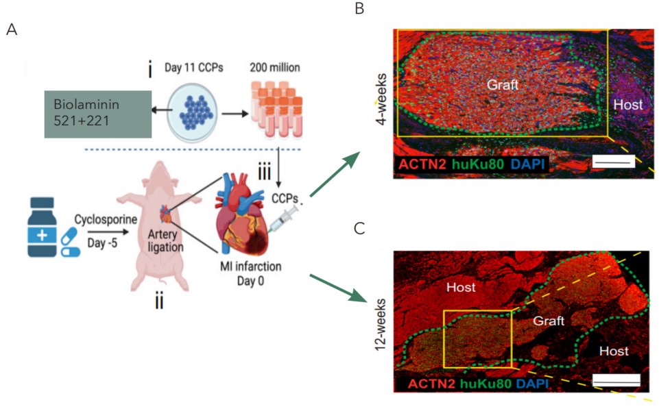 移植分化第11天的PSCs-CCPs至心肌梗死心脏及4周和12周的CMs特异性标志物的免疫组织化学染色代表性图像