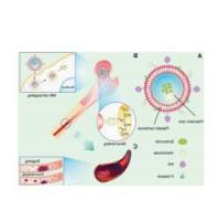 负载硼替佐米的聚合物纳米颗粒被阿仑膦 酸(骨靶向)和tPA(组织型纤溶酶原激活剂)修饰的血小板膜包裹 BTZ@NPs@PM-ALN/tPA