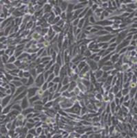 RKO细胞POLQ基因敲除株