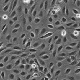 U2OS细胞PTPN11基因敲除株