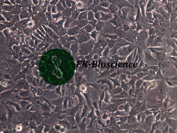 Hep 3B2.1-7 [Hep3B]人肝癌细胞【已通过STR鉴定】