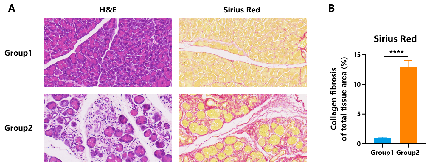 消化赛道再加速！南模生物慢性胰腺炎模型，让药效评价快人一步
