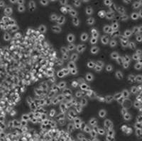 THP-1细胞GPI基因敲除株