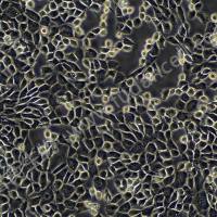 HT22 ；小鼠海马神经元细胞系（种属鉴定）