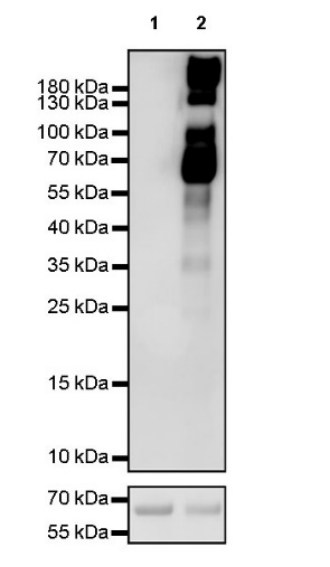 前沿修饰代谢醛修饰4-HNE的生理与病理作用：脂质过氧化产物的修饰机制与疾病关联