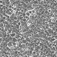 HEK293细胞B2M基因敲除株