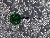 MKN-45、MKN45人胃癌细胞【已通过STR鉴定】