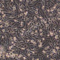 人乳腺癌细胞；MDA-MB-231 (STR)