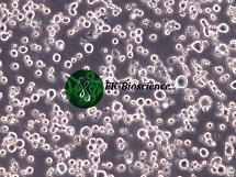 RPMI8226 [RPMI-8226] 人多发性骨髓瘤细胞【已通过STR鉴定】