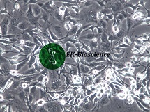 MDA-MB-436人乳腺腺癌细胞【已通过STR鉴定】