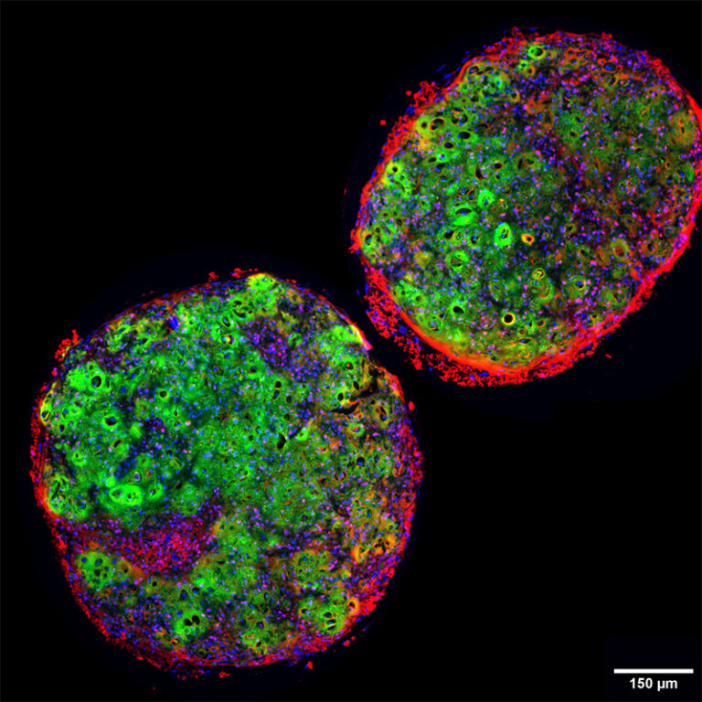 使用Qkine TGF-β1 PLUS (Qk010) 诱导iPSC衍生的中胚层祖细胞发生软骨分化而制成的软骨球体