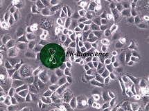 PL45；人胰腺导管腺癌细胞【已通过STR鉴定】PL45；人胰腺导管腺癌细胞【已通过STR鉴定】