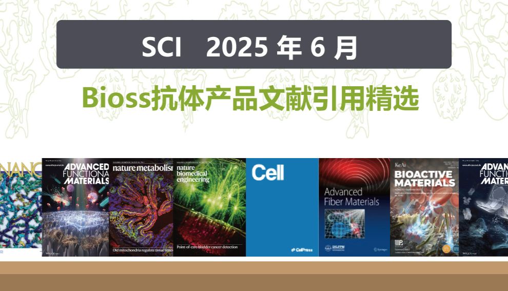 【2025年6月文献战报】Bioss 抗体新增高分文献精彩呈现