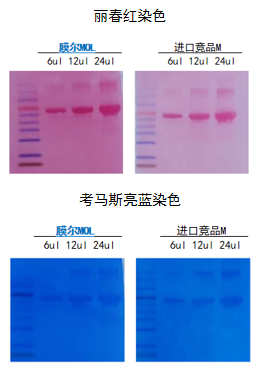 【可申请试用】“膜”力加倍!膜尔新材战神级PVDF膜横扫WB翻车现场—0.45μm精准孔径狙杀各类蛋白,背景纯净如冰川