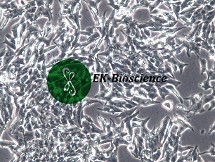 TT人甲状腺导管癌细胞【已通过STR鉴定】