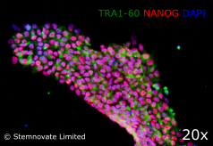 TGF-β1 PLUS在化学成分确定、无血清和无饲养层培养中高度有效维持iPSC多能性