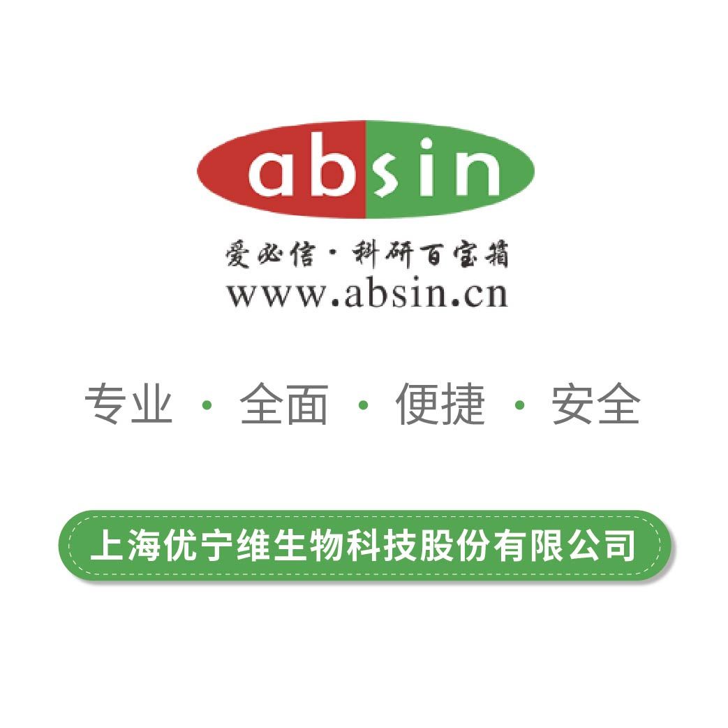 Rabbit anti-HBP Recombinant Monoclonal Antibody(506-82)【兔抗HBP重组单克隆抗体(506-82)】- abs190776