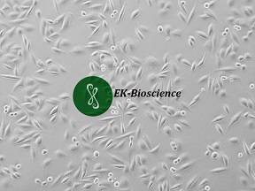 SiHa人子宫颈鳞状癌细胞【已通过STR鉴定】