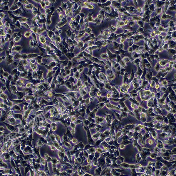 人神经母细胞瘤细胞;SH-SY5Y (STR)