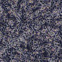 人神经母细胞瘤细胞；SH-SY5Y (STR)