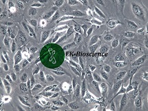 SV-HUC-1人膀胱上皮永生化细胞【已通过STR鉴定】