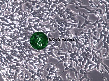 SH-SY5Y人神经母细胞瘤细胞【已通过STR鉴定】SH-SY5Y人神经母细胞瘤细胞【已通过STR鉴定】