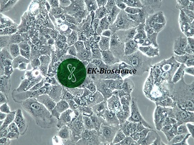 PLC/PRF/5人肝癌亚力山大细胞【已通过STR鉴定】