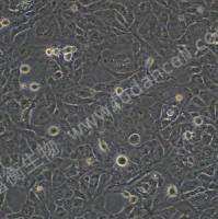 LX-2;人肝星形细胞