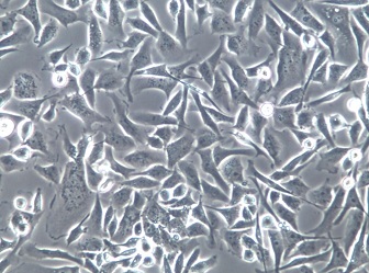 SJCRH30;人骨髓横纹肌肉癌细胞【已通过STR鉴定】