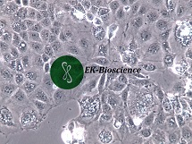 HuH-6人肝母细胞瘤细胞【已通过STR鉴定】