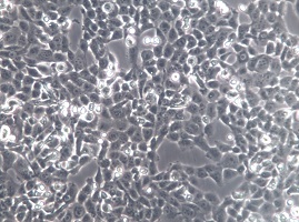 IOMM-Lee;人脑膜瘤细胞【已通过STR鉴定】