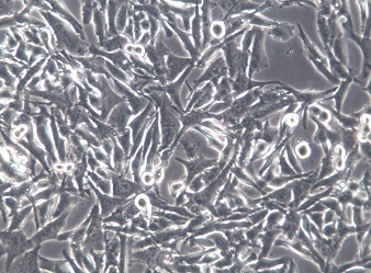 SK-MEL-5;人皮肤恶性黑色素瘤细胞【已通过STR鉴定】