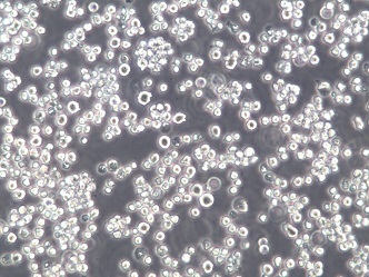 DB;人弥漫大B细胞淋巴瘤细胞【已通过STR鉴定】