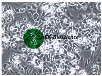 DMS 114;人小细胞肺癌细胞【已通过STR鉴定】