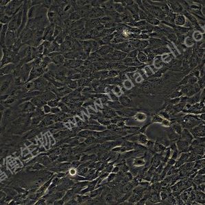 BEAS-2B ;人支气管上皮细胞(STR)